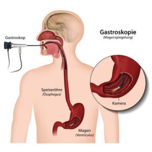 sanfte Gastroskopie, Magenspiegelung Wien